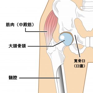 膝痛　股関節痛